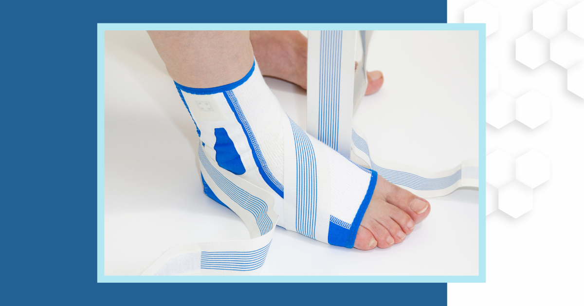 Get the jump on ankle sprains: Ankle sprain treatment